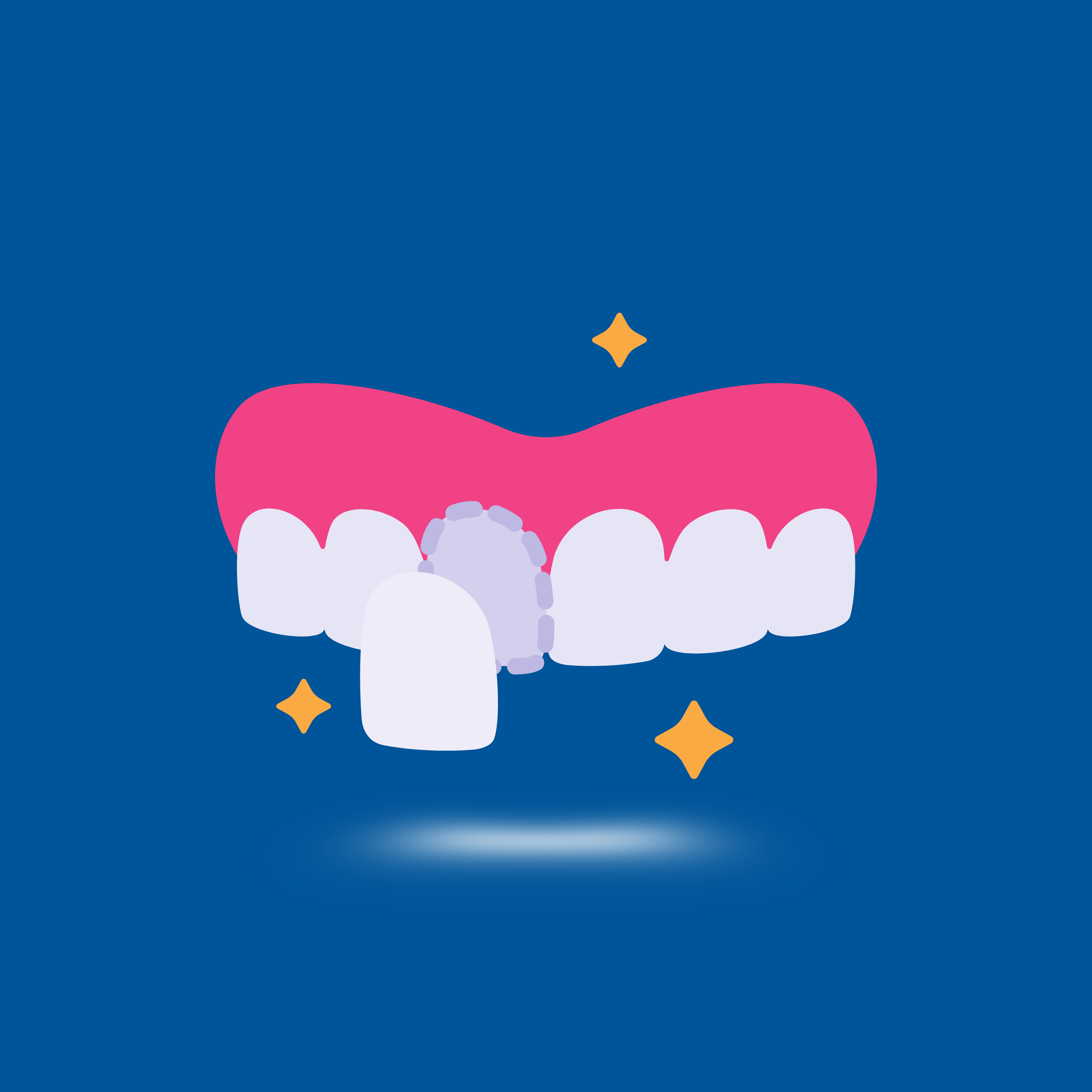 Domande frequenti sulle faccette dentali - Bclinic