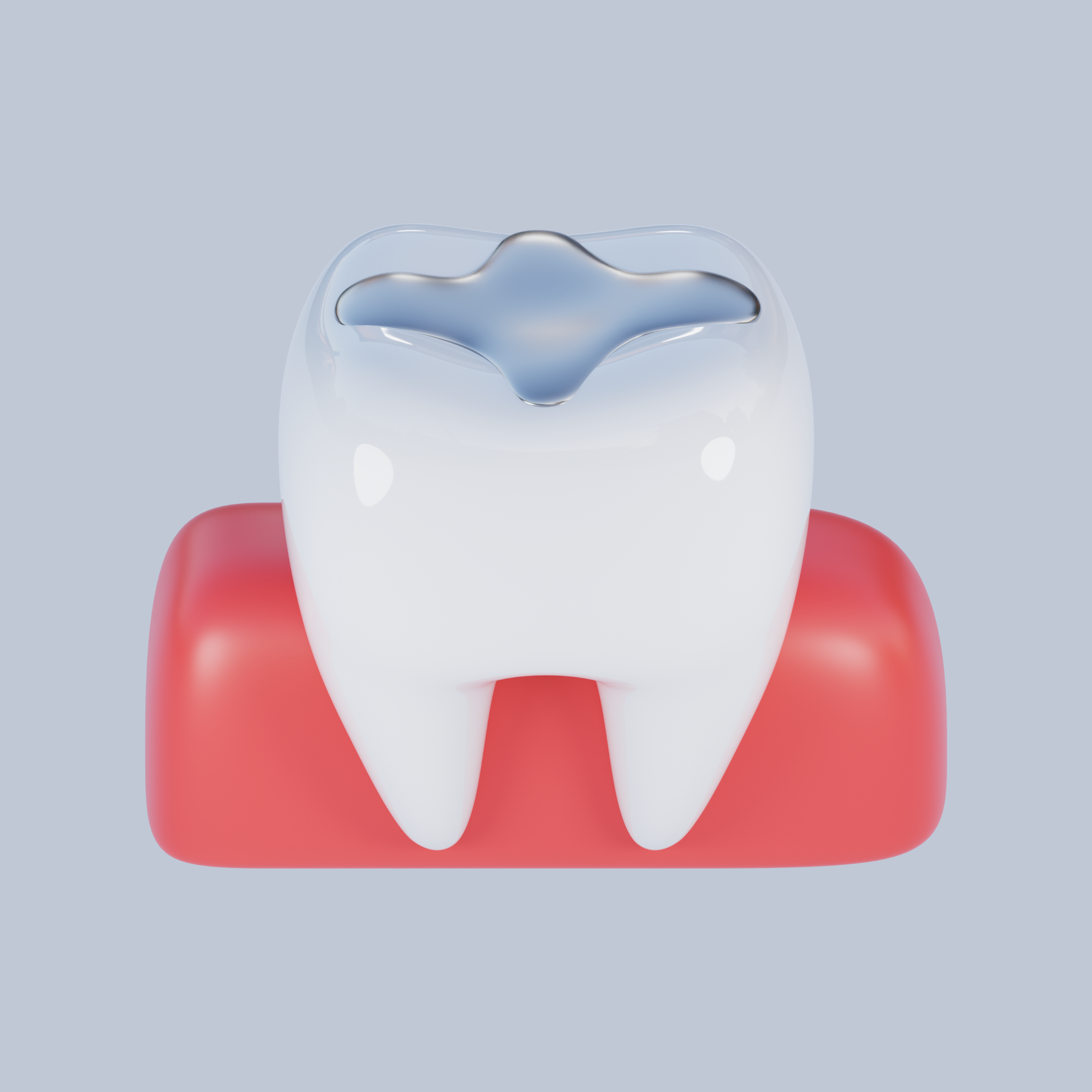 Otturazione dentale in corso su un dente cariato