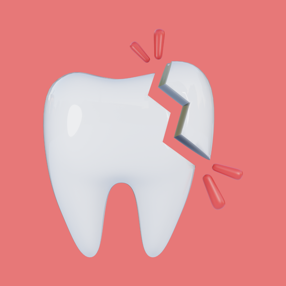 dente scheggiato con bordo irregolare visibile su incisivo superiore