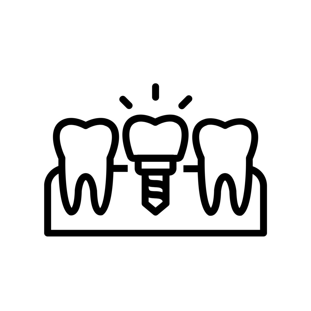 impianto dentale 