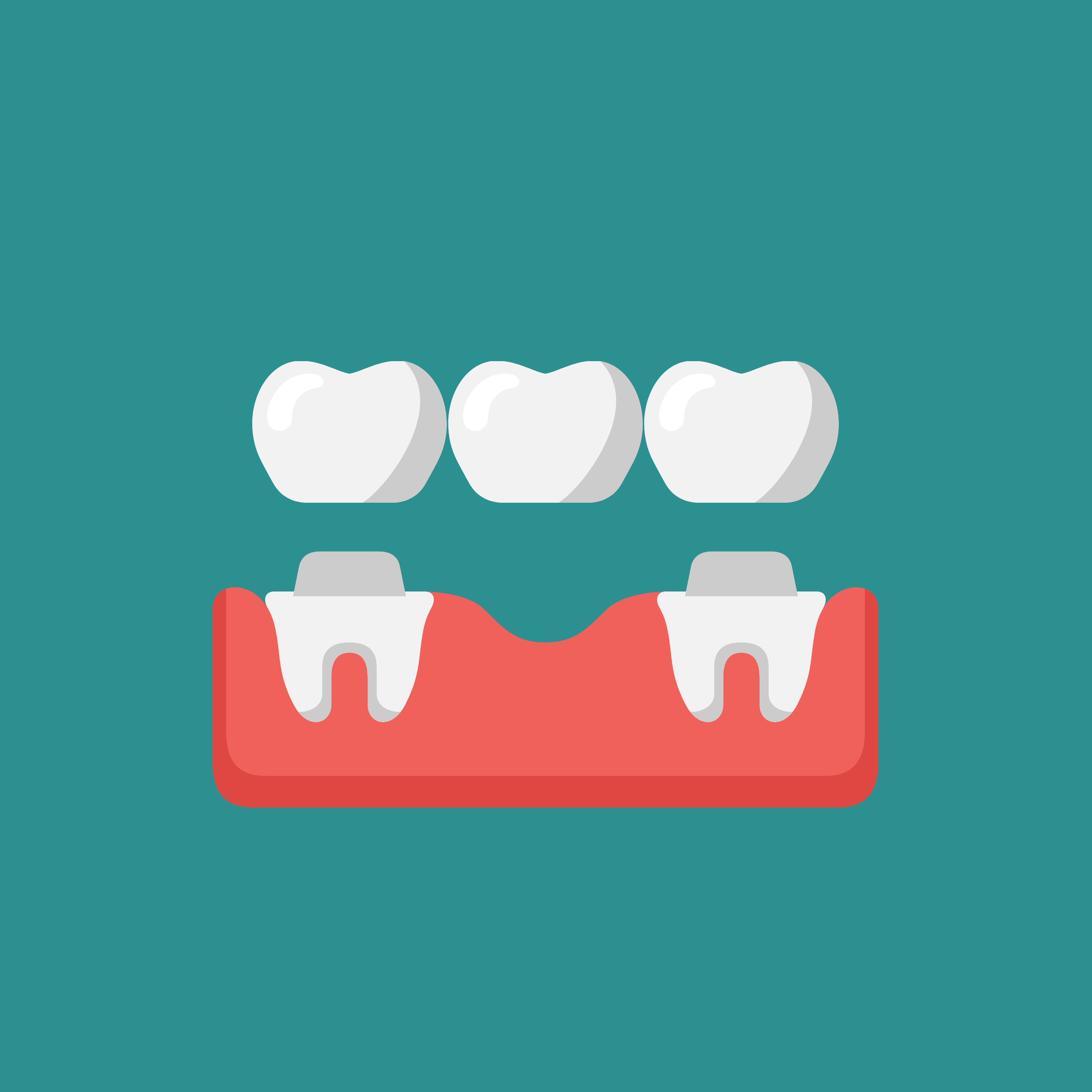 Confronto tra impianto dentale e ponte su denti naturali
