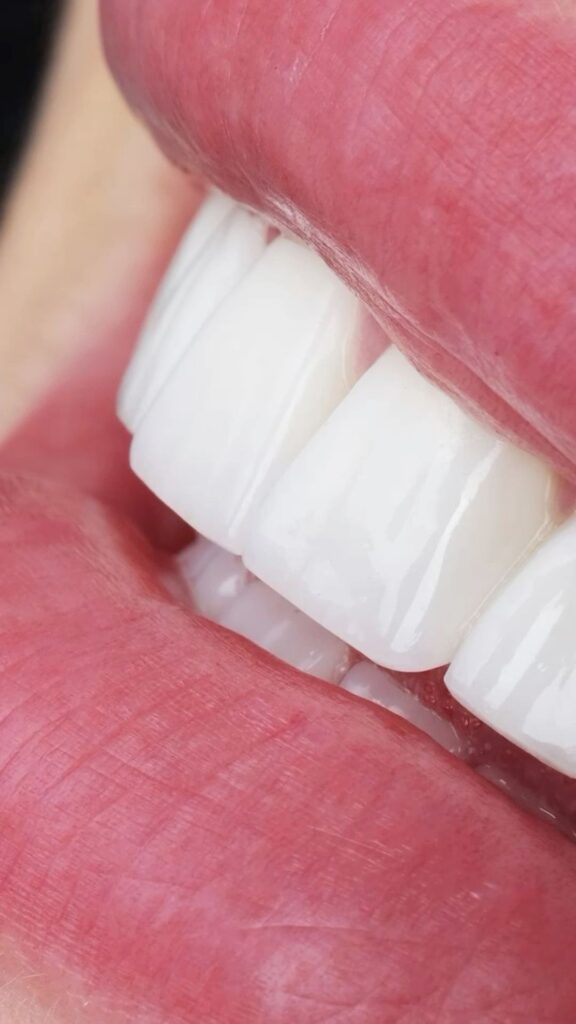 Visita dentistica presso Bclinic Seriate in provincia di Bergamo
